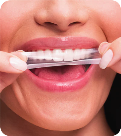 SmileStrips™ – Fitas Clareadoras de Alta Performance (Compre 1 Ganhe 35)