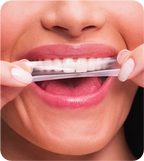 SmileStrips™ – Fitas Clareadoras de Alta Performance (Compre 1 Ganhe 35)