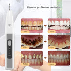 DentClean Pro™ – Removedor Elétrico de Tártaro e Manchas Dentais